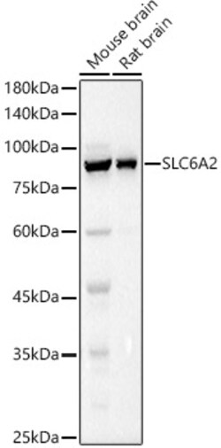 ABclonal Technology&nbsp;SLC6A2 Rabbit pAb
