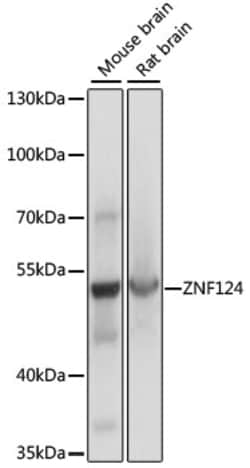 ABclonal Technology&nbsp;ZNF124 Rabbit pAb