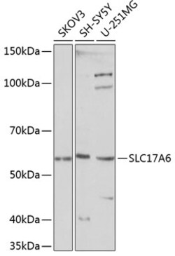 ABclonal Technology&nbsp;SLC17A6 Rabbit pAb