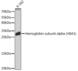 ABclonal Technology&nbsp;Hemoglobin subunit alpha (HBA1) Rabbit pAb