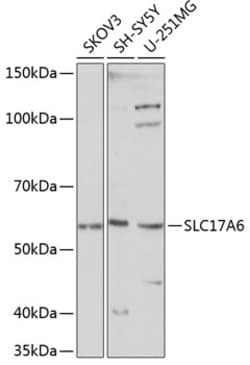ABclonal Technology&nbsp;SLC17A6 Rabbit pAb