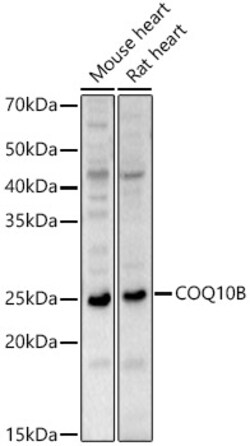 ABclonal Technology&nbsp;COQ10B Rabbit pAb