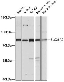 ABclonal Technology&nbsp;SLC26A2 Rabbit pAb