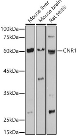 ABclonal Technology&nbsp;CNR1 Rabbit pAb
