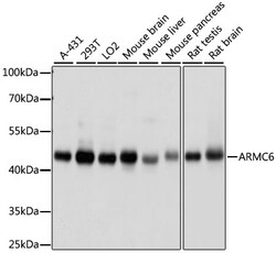 ABclonal Technology ARMC6 Rabbit pAb
