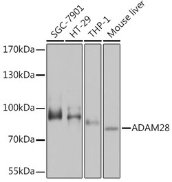ABclonal Technology&nbsp;ADAM28 Rabbit pAb