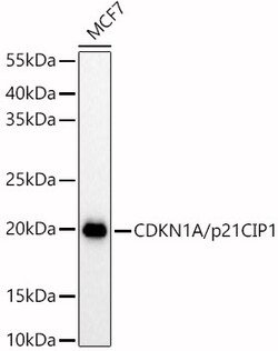 ABclonal Technology&nbsp;CDKN1A/p21CIP1 Rabbit pAb