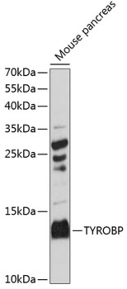 ABclonal Technology&nbsp;TYROBP Rabbit pAb