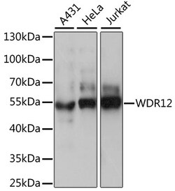 ABclonal Technology&nbsp;WDR12 Rabbit pAb
