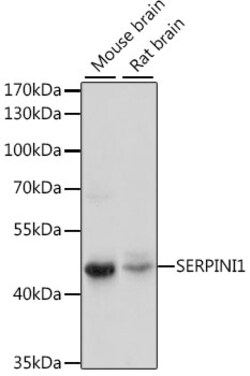 ABclonal Technology&nbsp;SERPINI1 Rabbit pAb