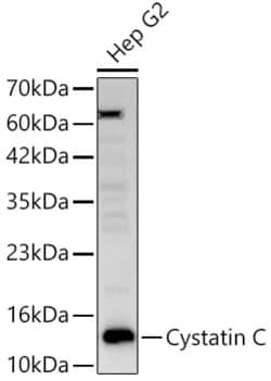ABclonal Technology&nbsp;Cystatin C Rabbit pAb