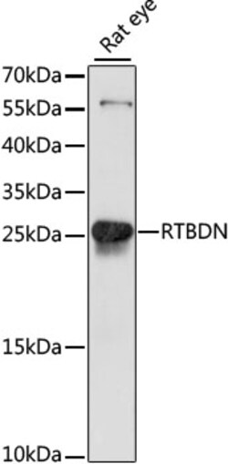 ABclonal Technology&nbsp;RTBDN Rabbit pAb
