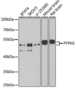 ABclonal Technology&nbsp;PTPN1 Rabbit pAb
