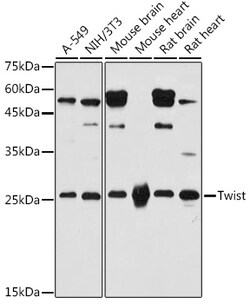 ABclonal Technology Twist Rabbit pAb, Quantity: Each of 1 | Fisher ...