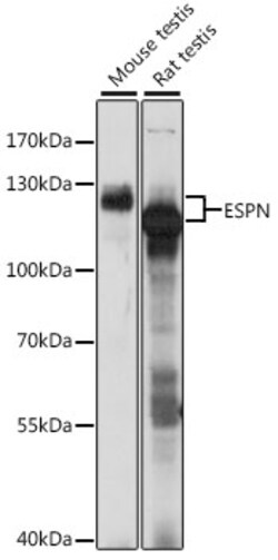 ABclonal Technology&nbsp;ESPN Rabbit pAb