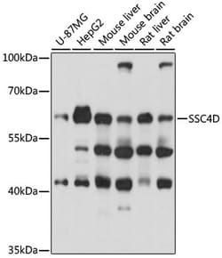 ABclonal Technology&nbsp;SSC4D Rabbit pAb