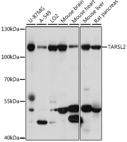 ABclonal Technology&nbsp;TARSL2 Rabbit pAb