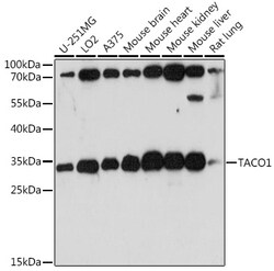 ABclonal Technology&nbsp;TACO1 Rabbit pAb