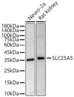 ABclonal Technology&nbsp;ANT2/SLC25A5 Rabbit pAb
