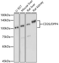 ABclonal Technology&nbsp;CD26/DPP4 Rabbit pAb
