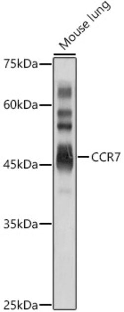 ABclonal Technology&nbsp;CCR7 Rabbit pAb