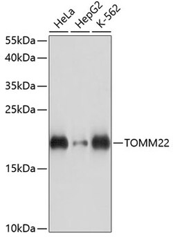 ABclonal Technology&nbsp;TOMM22 Rabbit pAb