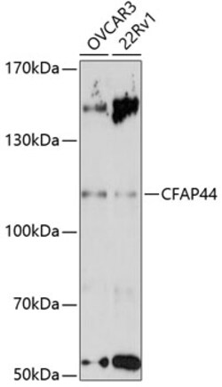 ABclonal Technology&nbsp;CFAP44 Rabbit pAb