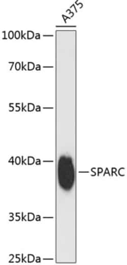 ABclonal Technology&nbsp;SPARC Rabbit pAb