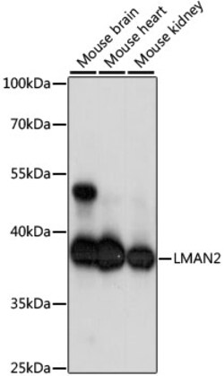 ABclonal Technology&nbsp;LMAN2 Rabbit pAb