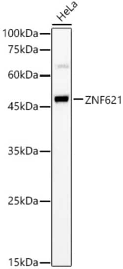 ABclonal Technology&nbsp;ZNF621 Rabbit pAb