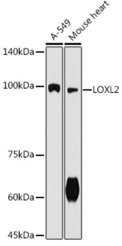 ABclonal Technology&nbsp;LOXL2 Rabbit pAb