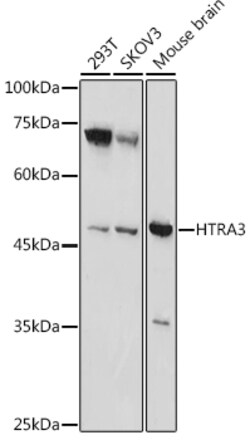ABclonal Technology&nbsp;HTRA3 Rabbit pAb
