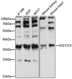 ABclonal Technology&nbsp;SULT1C4 Rabbit pAb