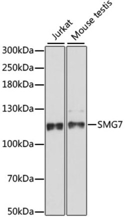 ABclonal Technology&nbsp;SMG7 Rabbit pAb
