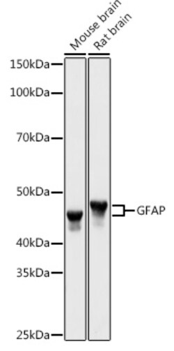 ABclonal Technology&nbsp;GFAP Rabbit pAb