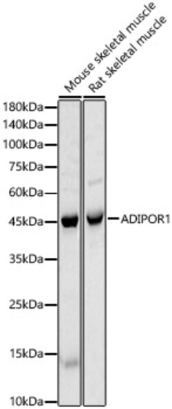 ABclonal Technology&nbsp;ADIPOR1 Rabbit pAb