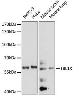 ABclonal Technology&nbsp;TBL1X Rabbit pAb