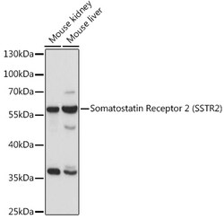 ABclonal Technology&nbsp;Somatostatin Receptor 2 (SSTR2) Rabbit pAb
