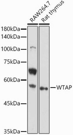 ABclonal Technology&nbsp;WTAP Rabbit pAb