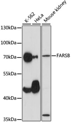 ABclonal Technology&nbsp;FARSB Rabbit pAb