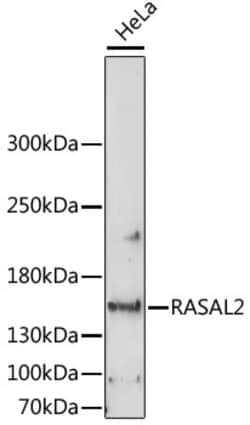 ABclonal Technology&nbsp;RASAL2 Rabbit pAb