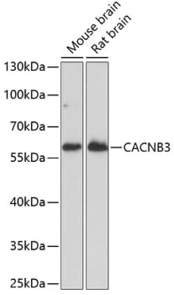ABclonal Technology&nbsp;CACNB3 Rabbit pAb