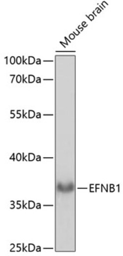 ABclonal Technology&nbsp;EFNB1 Rabbit pAb