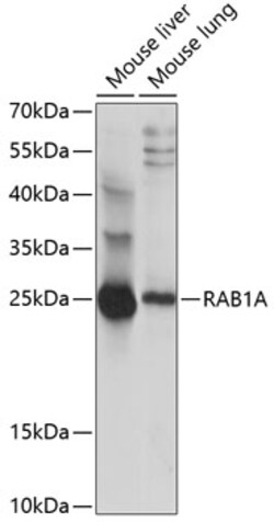 ABclonal Technology&nbsp;RAB1A Rabbit pAb