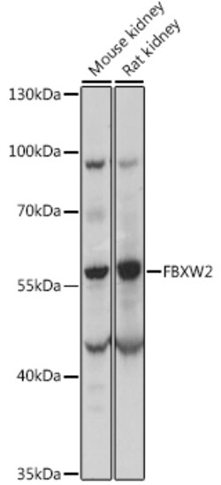 ABclonal Technology&nbsp;FBXW2 Rabbit pAb