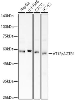 ABclonal Technology&nbsp;AT1R/AGTR1 Rabbit pAb