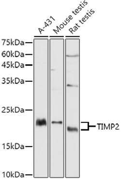 ABclonal Technology&nbsp;TIMP2 Rabbit pAb