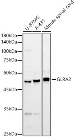 ABclonal Technology&nbsp;GLRA2 Rabbit pAb