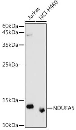 ABclonal Technology&nbsp;NDUFA5 Rabbit pAb