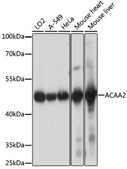 ABclonal Technology&nbsp;ACAA2 Rabbit pAb